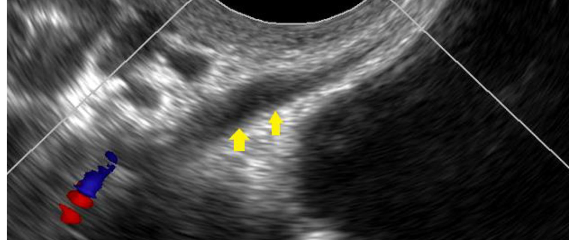 What is the Cost of an Ultrasound at a Radiology Center in Franklin, Tennessee?
