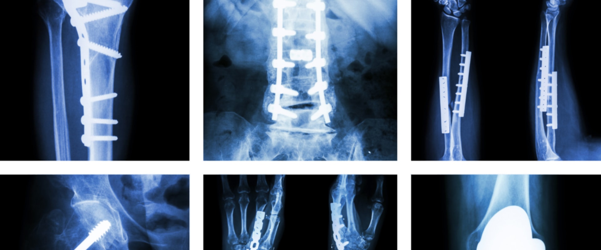Musculoskeletal Imaging Services in Franklin, Tennessee: Get the Best Care