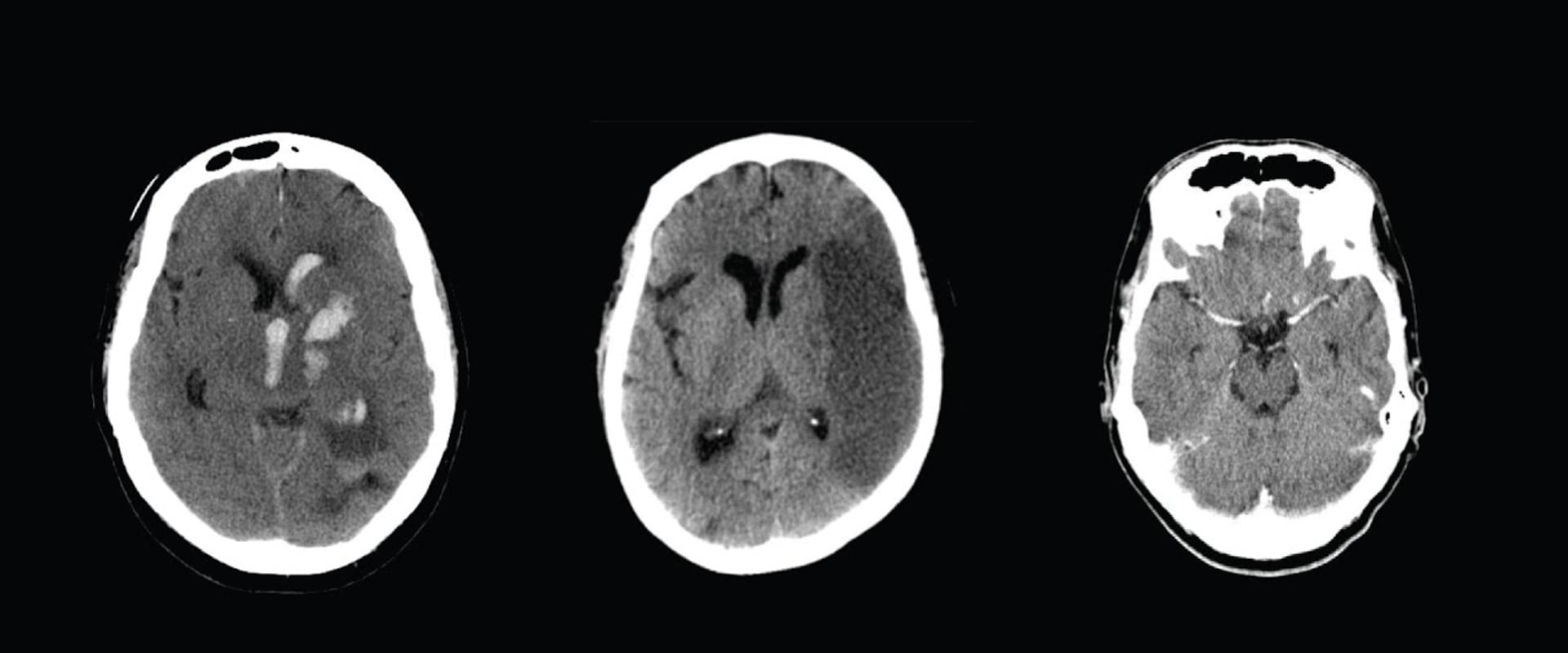 What is the Average Cost of a Nuclear Medicine Imaging Test in Franklin, Tennessee?