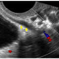 What is the Cost of an Ultrasound at a Radiology Center in Franklin, Tennessee?