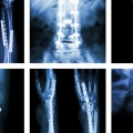 Musculoskeletal Imaging Services in Franklin, Tennessee: Get the Best Care