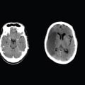 What is the Average Cost of a Nuclear Medicine Imaging Test in Franklin, Tennessee?