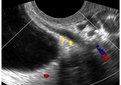 What is the Cost of an Ultrasound at a Radiology Center in Franklin, Tennessee?