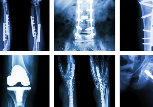 Musculoskeletal Imaging Services in Franklin, Tennessee: Get the Best Care