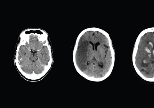 What is the Average Cost of a Nuclear Medicine Imaging Test in Franklin, Tennessee?